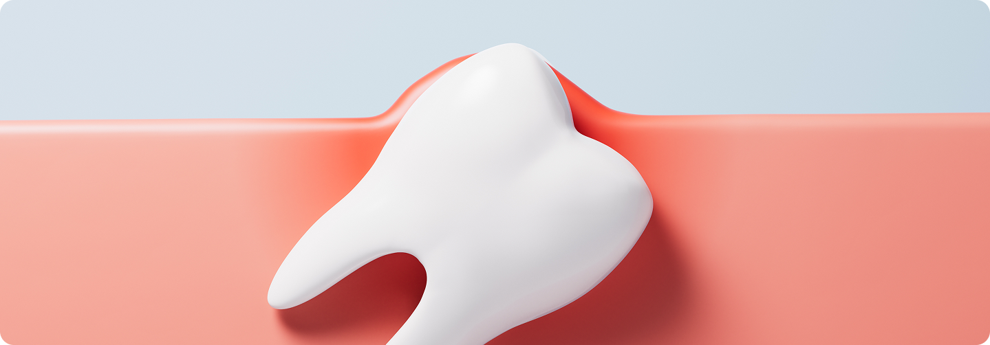 전체임플란트 3D 이미지